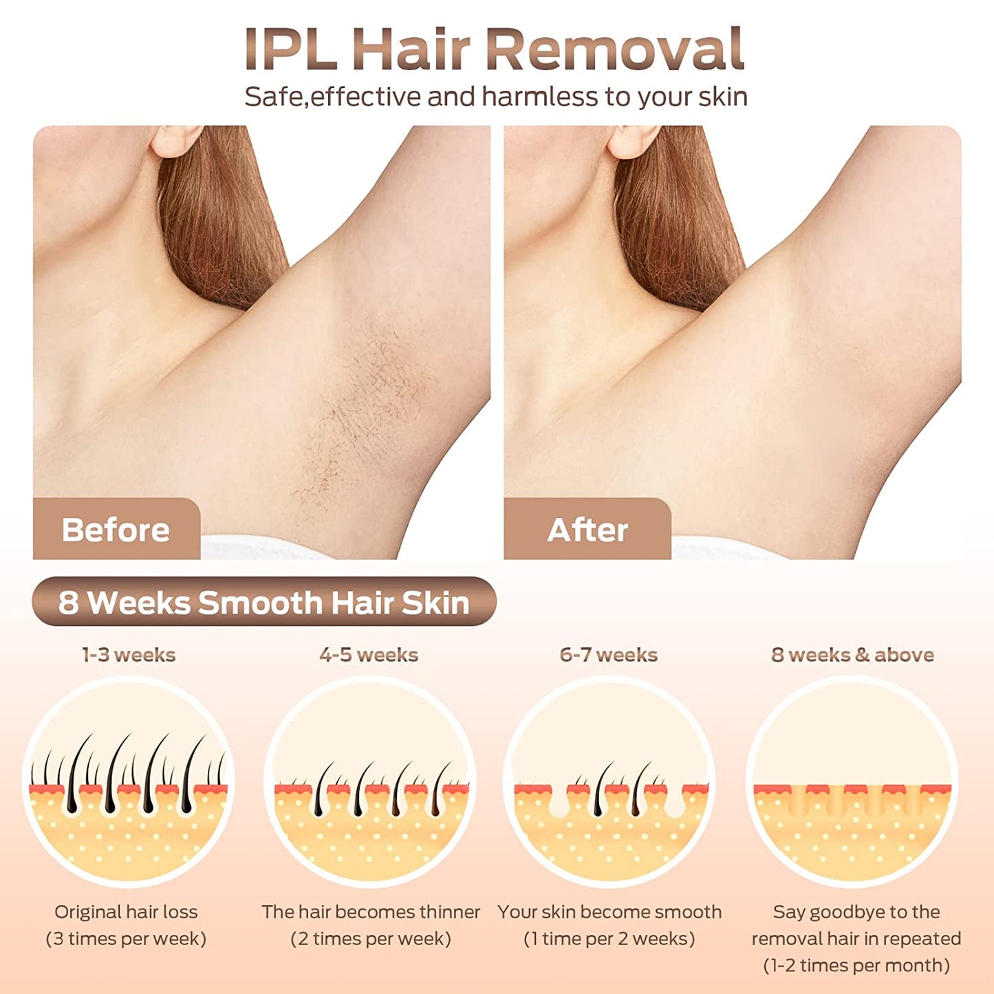 Laser Hair Removal, At-Home IPL Hair Removal for Women Permanent Hair Removal Device Upgraded to 999,900 Flashes Painless Hair Remover for Armpits Back Legs Arms Bikini Line